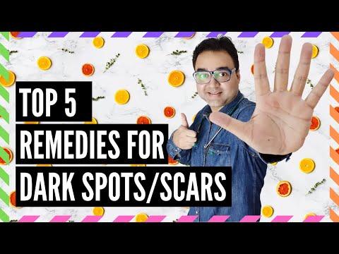 5 BEST REMEDIES To Remove PIMPLE MARKS In 7 Days (100% Results)